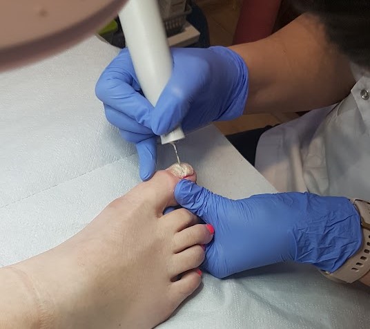 Kroki ku zdrowym stopom - Czym zajmuje się Podolog?