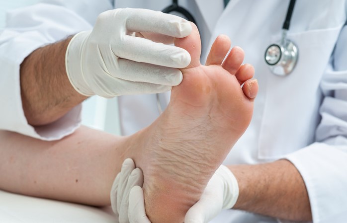 Usuwanie brodawek wirusowych stóp – Lekarz specjalista w białym fartuchu i rękawiczkach bada stopę pacjenta. Widoczny jest stetoskop na szyi lekarza, co podkreśla profesjonalizm i medyczny charakter zabiegu. Lekarz delikatnie trzyma stopę pacjenta, koncentrując się na jej dokładnym badaniu.