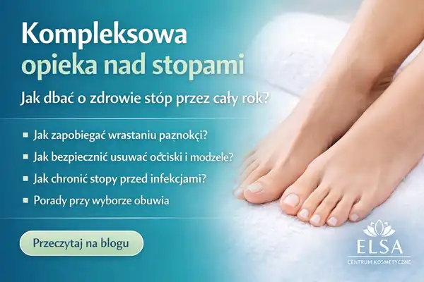 Kompleksowa opieka nad stopami – jak dbać o zdrowie stóp przez cały rok