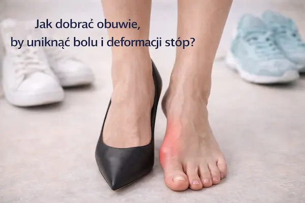 Jak dobrać obuwie, aby uniknąć bólu i deformacji stóp – zdrowe buty a profilaktyka problemów podologicznych