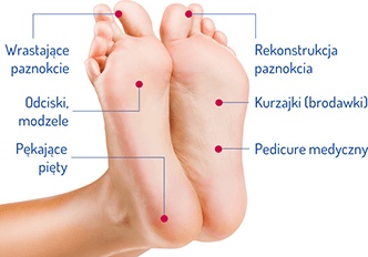 Najczęstsze problemy stóp i jak je rozwiązywać I Podolog Rzeszów