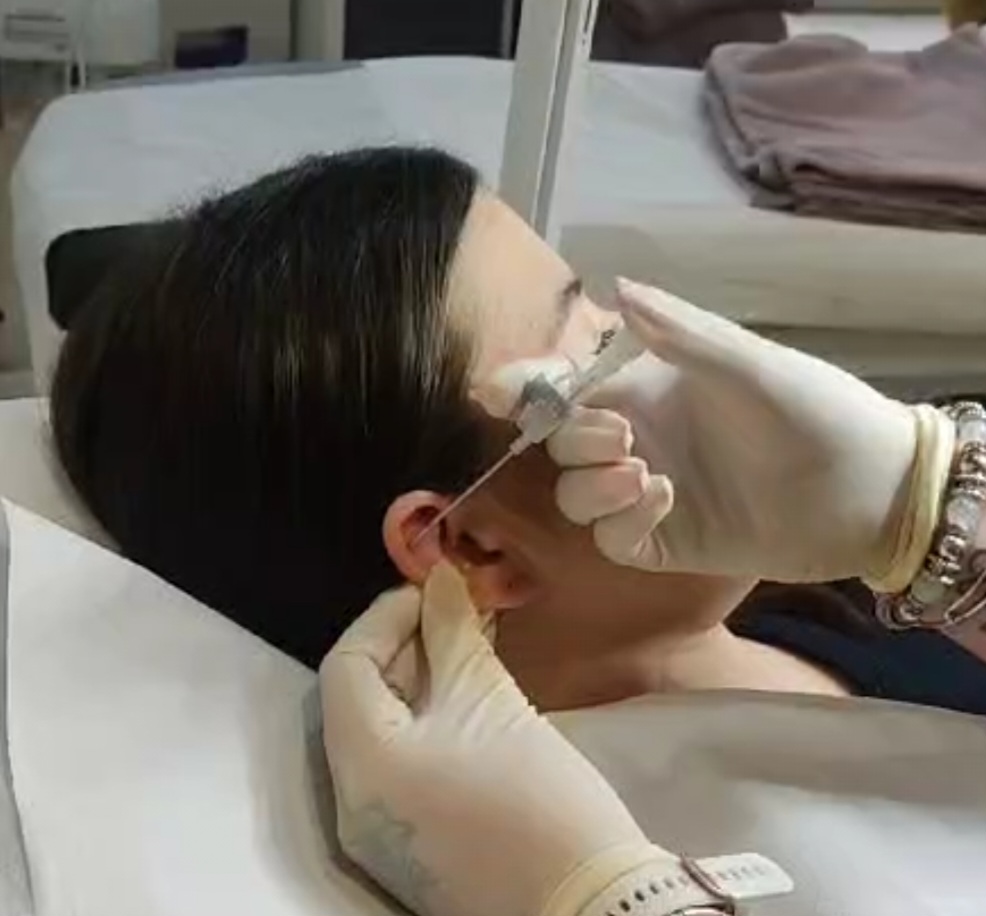 Piercing pistoletem i igłą - Co powinieneś wiedzieć?